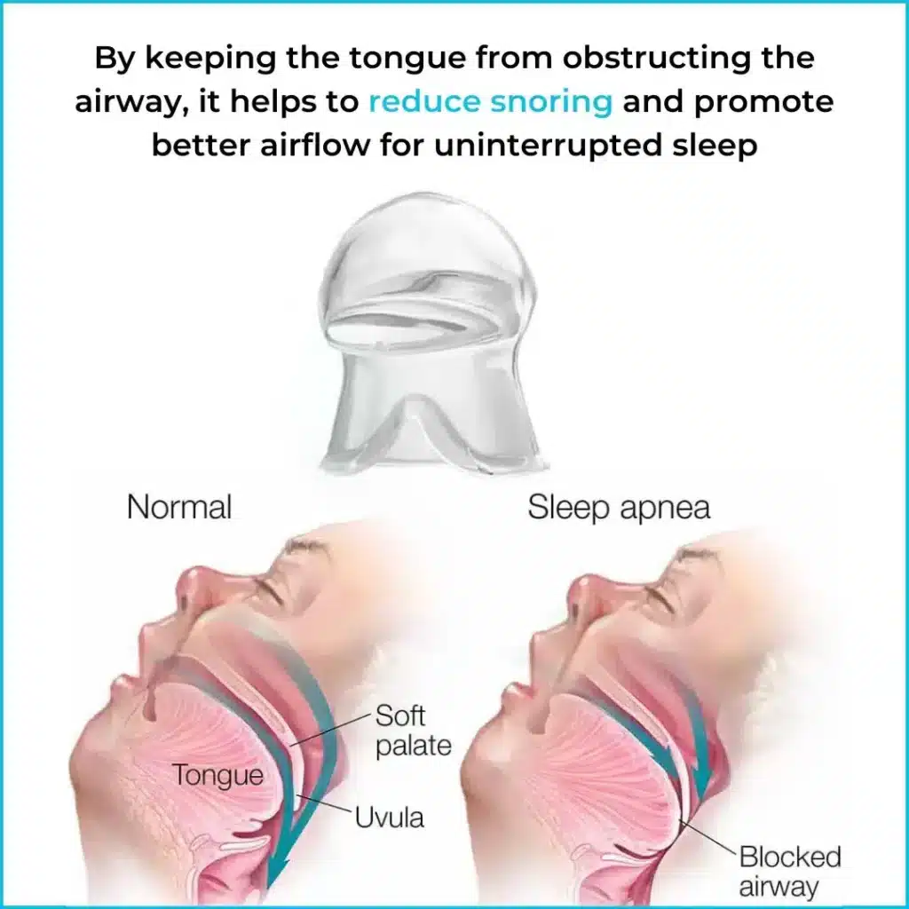 SnoreSnoozer Pro