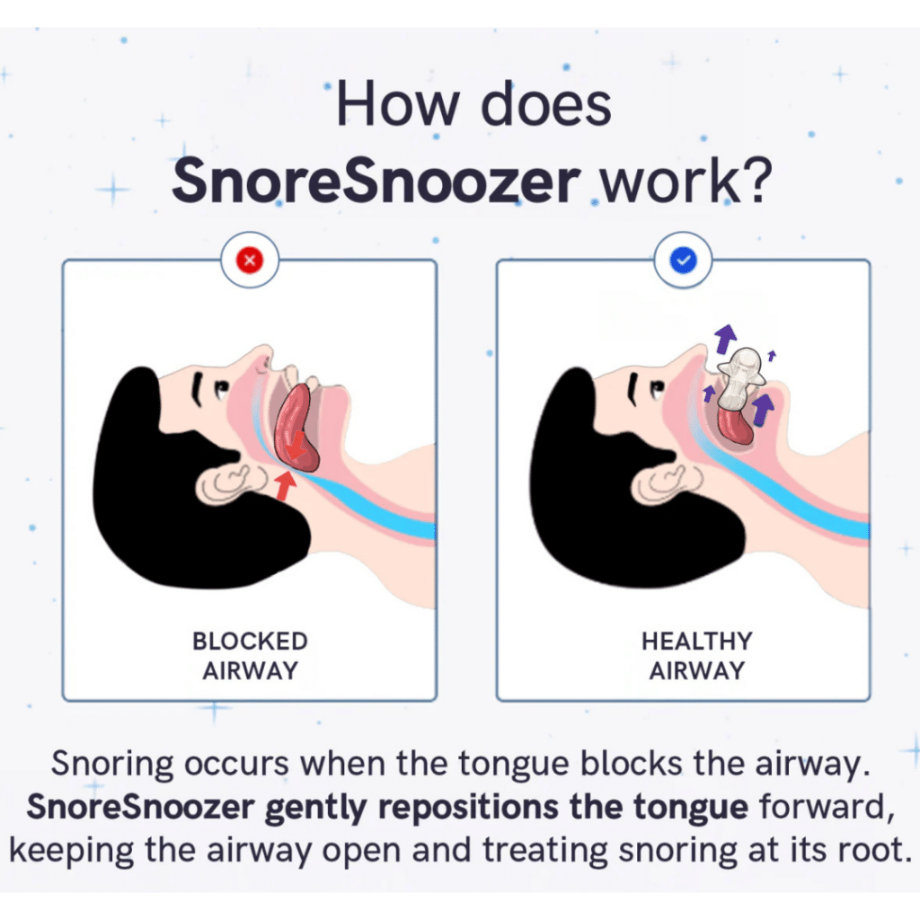 Snoresnoozer Pro (Official Retailer) [year]